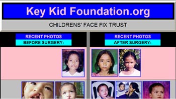 Free Surgery on Children Web Site 